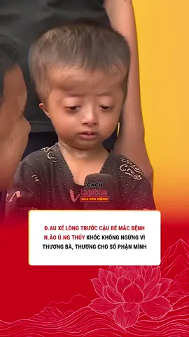 Em Mai Hoài Thương - Mái ấm gia đình Việt Tập 111. Làm sao có thể cầm lòng trước nỗi đ.au xé lòng của một đứa trẻ thơ, khi em phải gánh chịu căn bệnh q.uái á.c và số phận nghiệt ngã của mình. #hoasengroup #hoasenhome #maiamgiadinhviet #hoasenhomecsr #tonhoasen 
