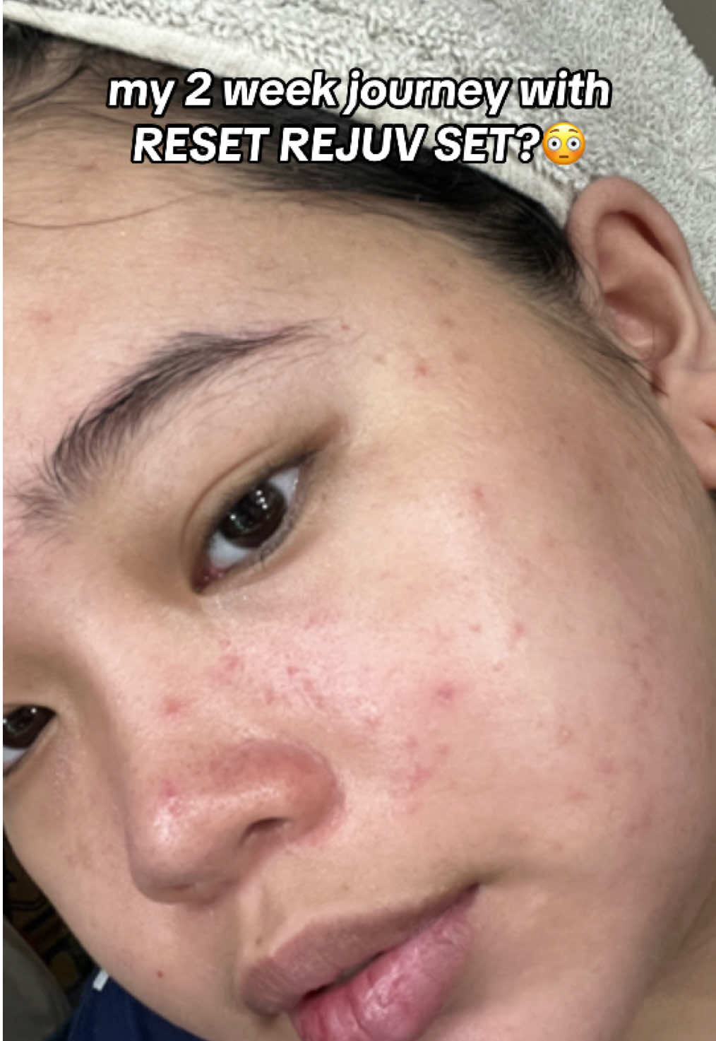 proof or it didn’t happen right? this is your sign para mag rejuv set na din! 😜 #saskin #resetbysaskin #saskinph #saskinrejuvenatingset #saskinresetrejuvanatingset #rejuv #rejuvinatingset #skincare #skincareph #sazchnalaparan #saskinbysachznalaparan   