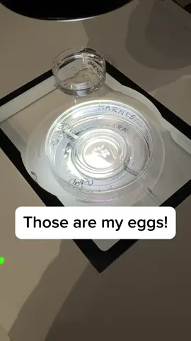I feel incredibly fortunate to have the opportunity to freeze my eggs and to be so deeply involved in the process. I have no regrets and I am so grateful to work with such a great clinic and lab @newlife! It’s surreal to see my eggs in the dish and under the microscope and it only solidifies my passion for this field and the love I have for the patients that undergo this process to grow their families. #ivf #ttc #eggfreezing #ivfjourney #reproductivehealth #infertility #embryology #womeninstem #fertilitypreservation #fyp 