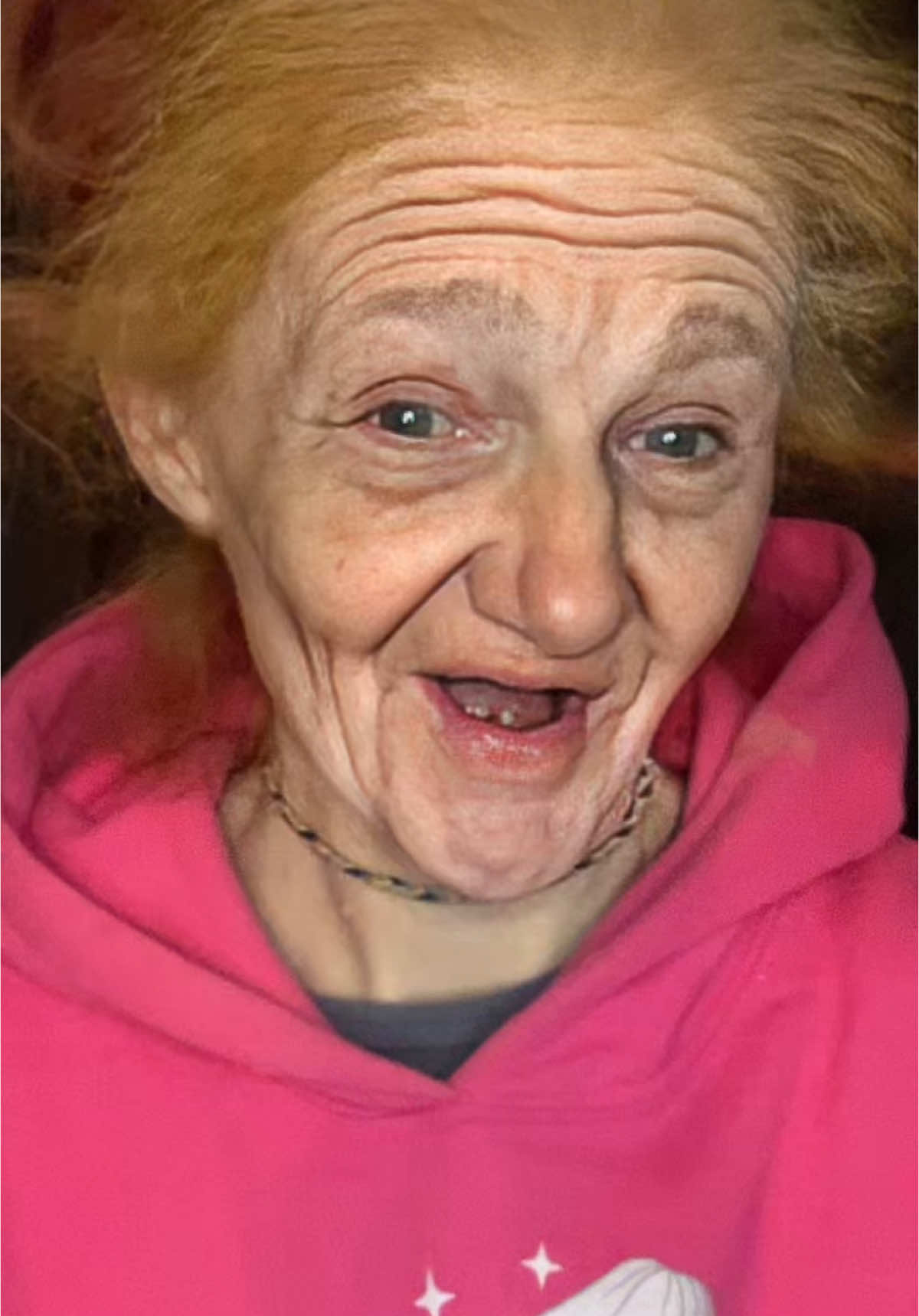 “You've got to have a sense of humor to keep your sanity”-Lance Bass @👑Denture Queen 👑 #transition #transformation #transformação #makeup #denturequeen #queen #omg #yas #denturegang #gummy #shapeshift #makeuptransformation #noteeth #metamorphosis #fyp #foryou #denturegangnoshame #gummysmile #dentureconfidence #beauty #cosmetics #mua 