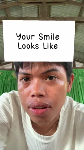 #goodvibes #viral #trending #litotaudi 