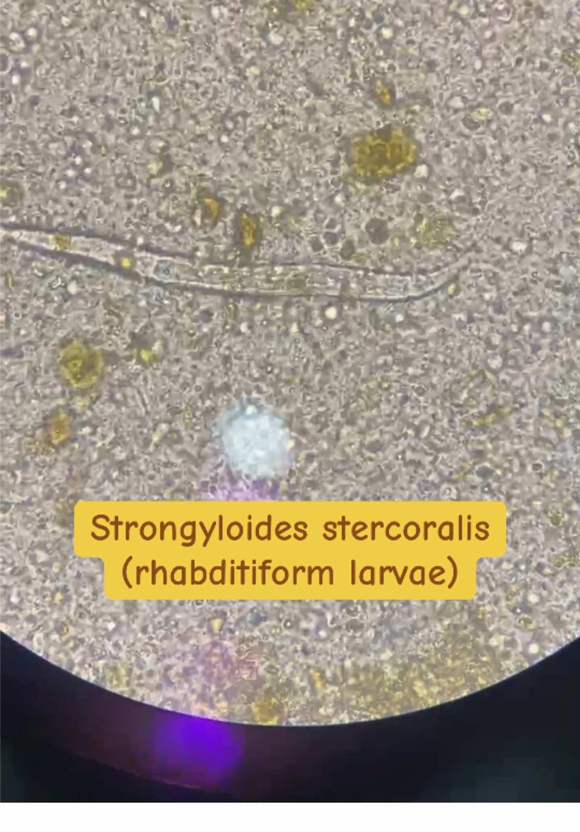 Strongyloides stercoralis rhabditiform larvae seen under microscope #parasitology #microscopy #parasite #medtechknows #medicaltechnologist #medtechph #medtechtok #medtechlife #fyp #medicallaboratoryscientists 
