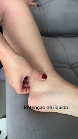 A retenção de líquido e o edema nas pernas são condições comuns que podem ser causadas por vários fatores, desde hábitos do dia a dia até problemas médicos subjacentes. Ambos envolvem o acúmulo excessivo de líquido nos tecidos, especialmente nas extremidades inferiores, levando a inchaço e desconforto. Causas comuns 	1.	Fatores cotidianos e comportamentais:       •   Permanecer em pé ou sentado por longos períodos.       •   Consumo excessivo de sal (sódio).       •   Desidratação, que faz o corpo reter mais líquido.       •   Uso de sapatos apertados ou roupas que comprimem a circulação. 	2.	Condições médicas:       •   Insuficiência venosa: Dificuldade das veias em retornar o sangue ao coração, causando acúmulo de líquido nas pernas.       •   Problemas cardíacos: Insuficiência cardíaca pode levar ao acúmulo de líquido no corpo.       •   Doenças renais: A capacidade dos rins de filtrar e remover líquidos fica comprometida.       •   Doenças hepáticas: Condições como cirrose podem alterar a regulação dos fluidos no organismo.       •   Linfedema: Acúmulo de líquido linfático devido a obstrução nos vasos linfáticos.       •   Trombose venosa profunda (TVP): Formação de um coágulo em uma veia profunda, causando inchaço localizado.       •   Hipotireoidismo: Pode causar retenção de líquidos devido ao metabolismo reduzido. 	3.	Medicamentos:       •   Anti-hipertensivos (como bloqueadores dos canais de cálcio).       •   Corticoides.       •   Antidepressivos.       •   Hormônios (como terapia de reposição hormonal ou anticoncepcionais). 	4.	Alterações hormonais:       •   Ciclo menstrual (especialmente antes da menstruação).       •   Gravidez.       •   Menopausa. Sintomas associados    •   Inchaço visível nas pernas, tornozelos e pés.    •   Sensação de peso ou rigidez nas extremidades.    •   Pele esticada ou brilhante.    •   Impressões temporárias ao pressionar a pele (edema com fóvea).    •   Dor ou desconforto na região inchada.
