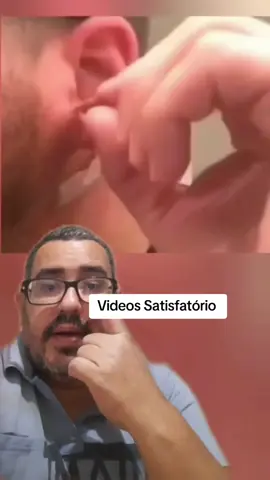 Videos Satisfatório #cravos #cravononariz #removedordecravos #satisfying #limpezasatisfatoria#cyst #big #abscess #stinks #pue #pimplesolution #blackhead #acne #infected 