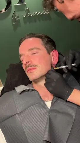 So satisfying 😍 #cardiff #penarth #clinic #fillerformen #aestheticsformen #facialsformen #tailoredtoyou #lovemyjob 