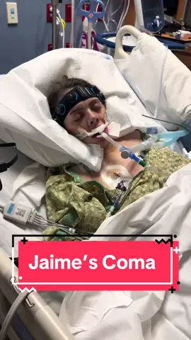 Jaime was put into a short medically induced coma to stop fight status epilepticus after about 17 convulsive seizures. SUDEP is a real. Epilepsy TAKES lives. It has stolen so much of her life. Please if anyone could comment something supportive and nice for her to wake up to, that would mean the world to us. Her faith and light once filled the room. Now, in a fragile stillness, we hold our breaths, waiting for her to wake from this silence. 💔 #HopeForRecovery #EpilepsyAwareness #HopeForRecovery #FightForHer #ComaAwareness #LoveAndHope 