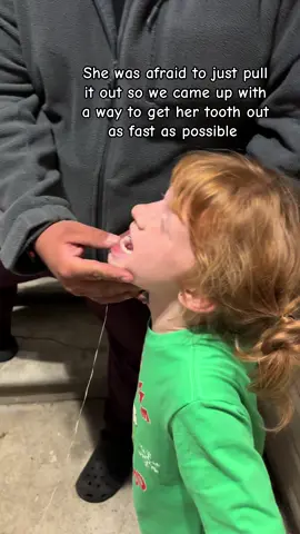 We havent found the tooth yet😢