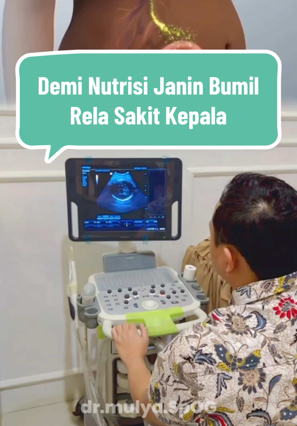 Demi nutrisi janin, bumil rela sering sakit kepala pada saat hamil #fyp #spog #dokterkandungan #usg4d #bumilsakitkepala 