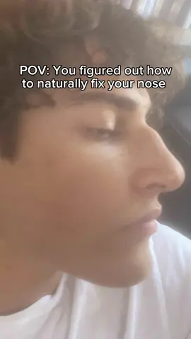 How to naturally fix your nose🫡  #nosejob #looksmax 