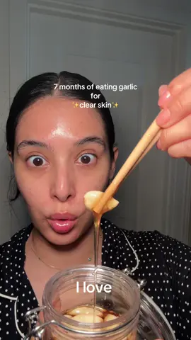 Results at the end🫶🏽 #hormonalacnejourney #skintransformation #garlicforclearskin #clearskin