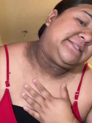 Eliminates acanthosis nigricans, reduces neck darkening, brightens skin and SPF 30+ Neck Protection