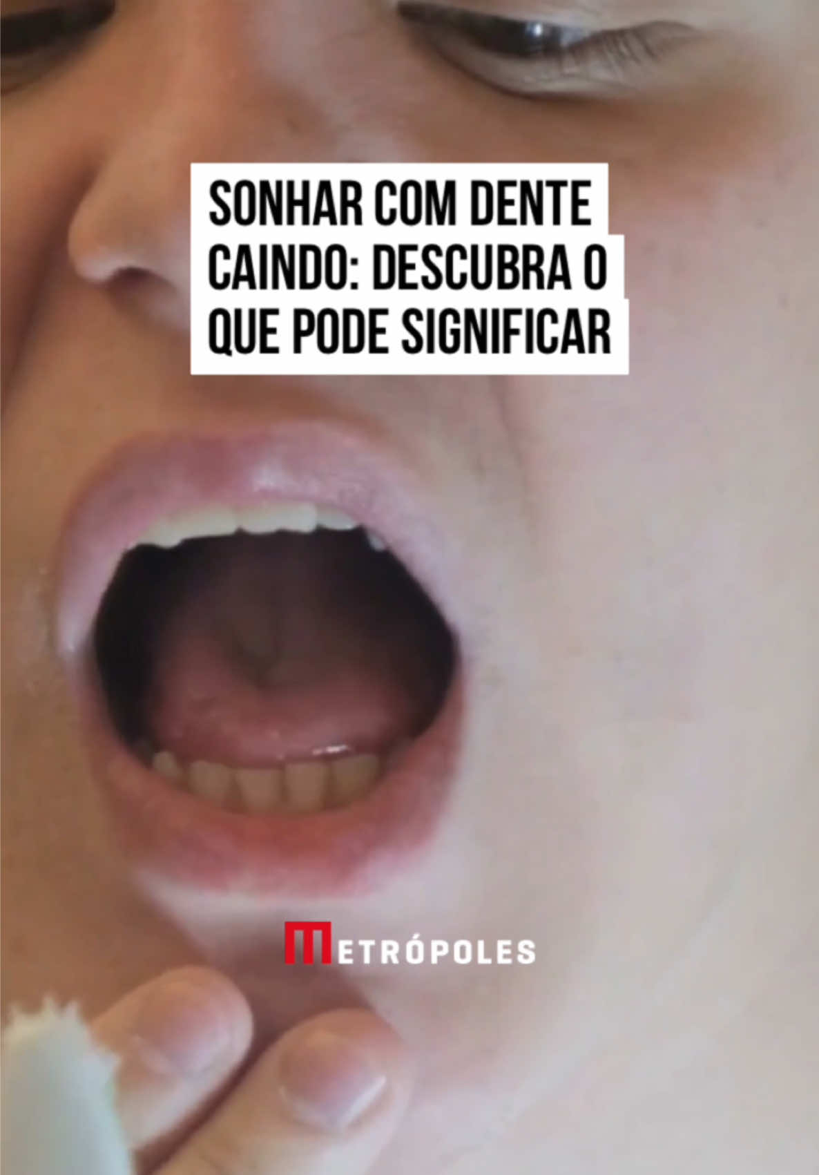 🦷🛏️😴 Sonhar com #dente caindo é algo bastante comum. Esse #sonho, considerado pesadelo por muitos, pode estar relacionado ao seu momento atual. Ficou curioso? A seguir, descubra o significado de sonhar com dente caindo. O que pode significar sonhar com dente caindo? Primeiramente, esse sonho pode refletir o receio de perder algo importante ou de mudanças drásticas. Esse sonho pode surgir em momentos de incerteza ou transições significativas na vida pessoal ou profissional, e que estejam algum desconforto. Mudanças assustam, principalmente aquelas que não temos controle. #tiktoknotícias 