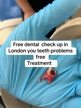 ##free check up teeth in London