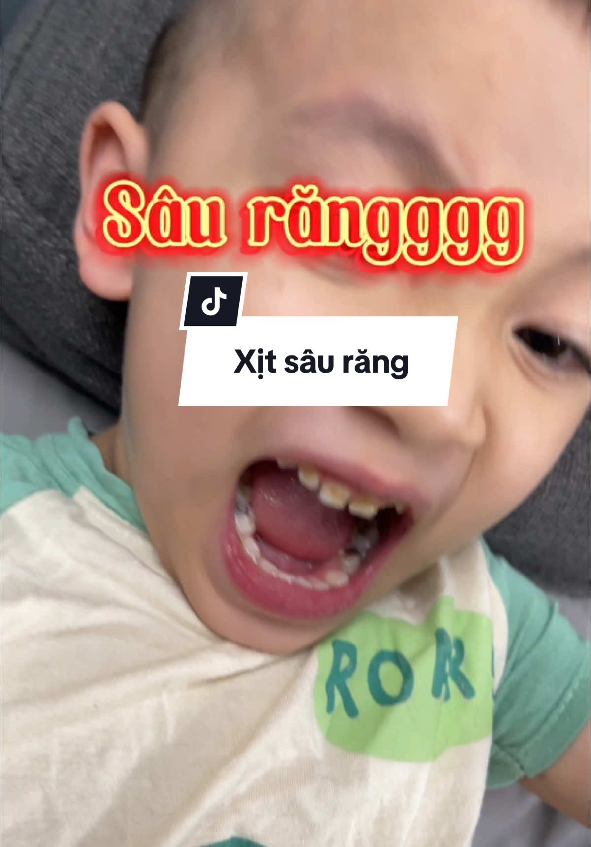 Chân ái ạ#trending #xitsaurangchobe 