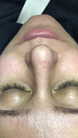 #تنظيف_البشرة #تنظيف_عميق #اهتمام_وعنايه #تجميل_الوجه #اهتمام_وعنايه #السعودية #تفتيح_البشرة #اهتمام_وعنايه 