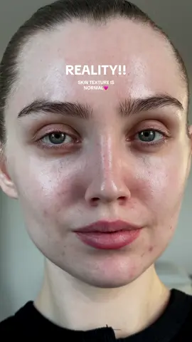 Filters can be so realistic so please remember skin texture is normal and you are beautifully human 🥹🩷  #skin #filter #filtervsreality #reality #nofilter #realskin #skintextureisnormal #skintexture #makeup #skincaretips #skintok #MentalHealth #selflovejourney #SelfCare #loveyourself 