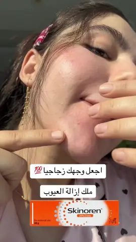 افضل كريم طبي ✅ يزيل حب الشباب ويقلل منه ✅يمنع تغير لون البشرة ✅إزالة كافة البقع ✅ يزيل تغير اللون حول الشفاه ✅يزيل البقع الجلدية وبقع حب الشباب ✅لأصحاب البشرة الحساسة ليس مشكلة وجيد ✅ يمنح البشرة إشراقة توجد نسخ كثيرة من هذا الكريم في الأسواق، واعلموا أن الأصل متوفر لدينا #گەیاندنمان_هەیە_بۆ_هەموو_کوردستان🚕 
