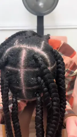 Hoping this helps someone that suffers from dandruff like I do! #dandrufftreatment #dandruffremovel #dandruffsolution #hairtips #flaky #flakyscalp #dryscalp #dryscalpremedy #hair 