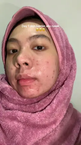 gg si nih moissttt