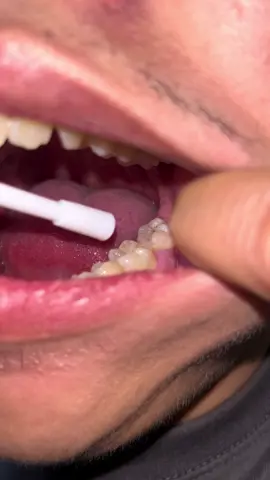 Sobrang ganda netong product na 'to #toothachespray #toothachepain #sakitsangipin 