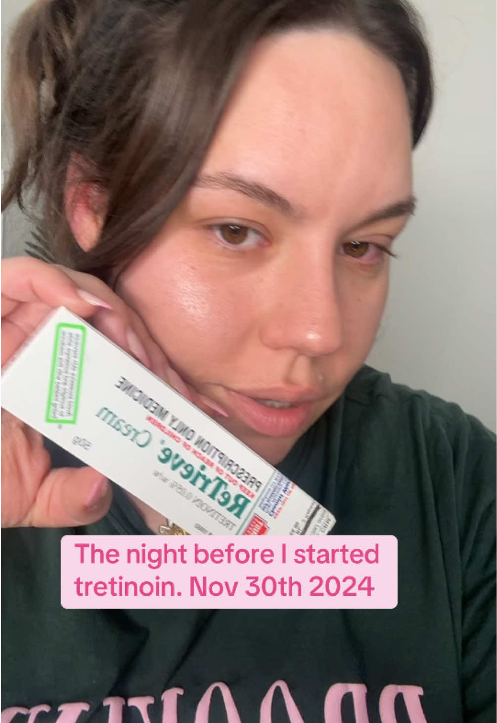 We will check in wirh my tretinoin journey at a later date 🤪 #tretinoin #vitamina #retinoid #tretinoinjourney #louisebbeauty #louisestretjourney 