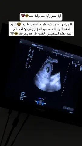 #fyp 🥹 #الله_يطعم_الجميع_الذرية_الصالحة_🥰  #firstbaby🥰🤰 #alhmdulillah 🤍