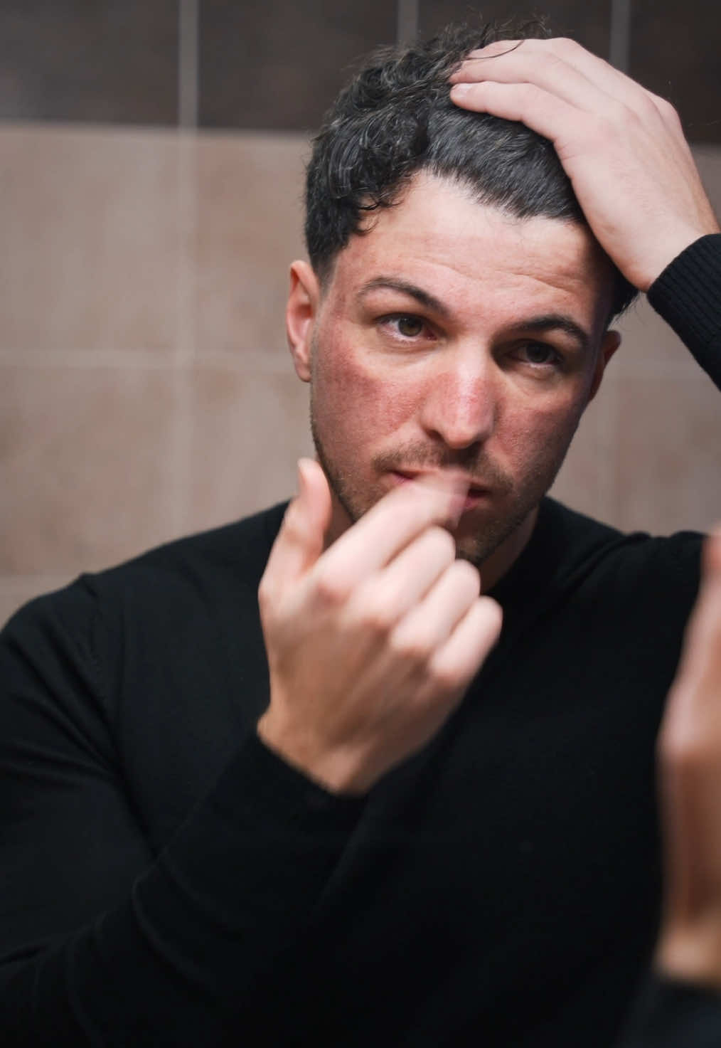 Ho la faccia ustionata 💀 #curadellapelle #curadeicapelli #trattamentiestetici #laserpelle #acne #cicatriciacne #skincare #trattamentoacne #posttrapianto #primaedopo #trasformazione #GlowUp #pelleperfetta #ettorecasolincapelli #trapiantodicapelli 