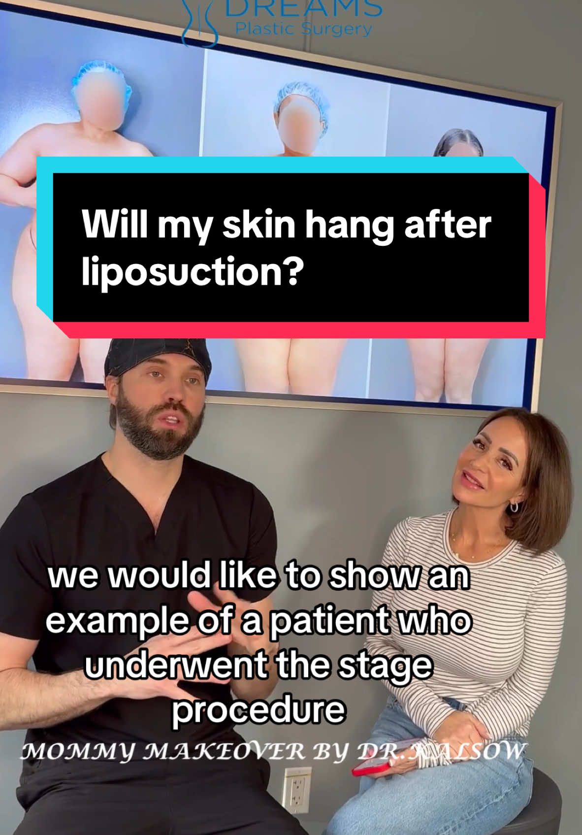 Dr.Kalsow explains how the skin looks  after just liposuction, and then if you get a tummy tuck.   #tummytuckjourney #tummytuck #lipo360 #lipo360andbbl #liposuction #mommymakeover #transformation #beforeafter #surgerytiktok #plasticsurgeonsoftiktok 