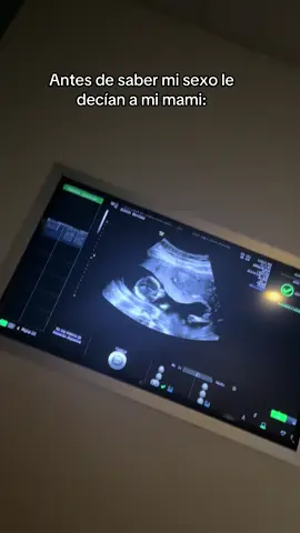 JAJAJAJ los cayo a todos mi bbita🤣🥰