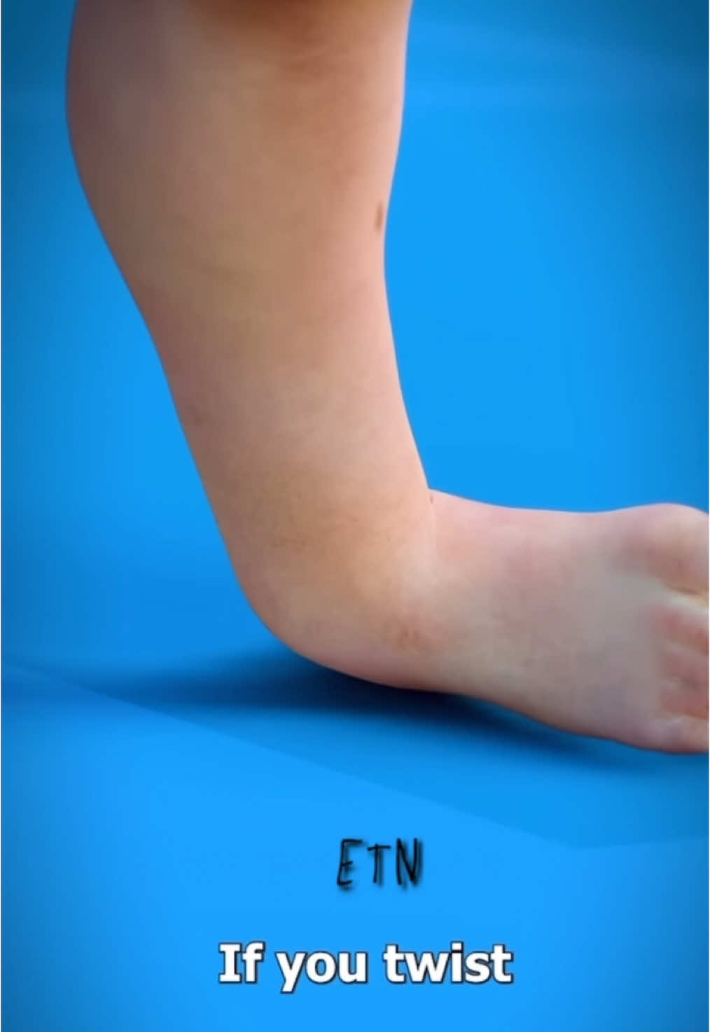 What happens if you twist your ankle: #ankle #twist #zackdfilms #foot #torn #ligament #edit #foryou #foryoupage #fy #viral #viral #animation #blowthisupforme #neymar #football