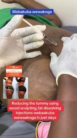 ###viral #foryoupage❤️❤️ #stretchmarkremoval ##alienskinug😂🔥🔥 #kampala_uganda🇺🇬🇺🇬🤝 #faridahnakazibwe18 #kampala 