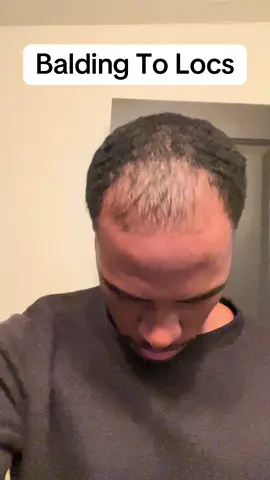 Hair Growth Journey been real #hairtransplant #hairtransformation #hairgrowth #bald #confidence #relatable #happiness #locs #hairstyle #blackmen #johnnyhiero @Bosley Medical @Touched by Angel 