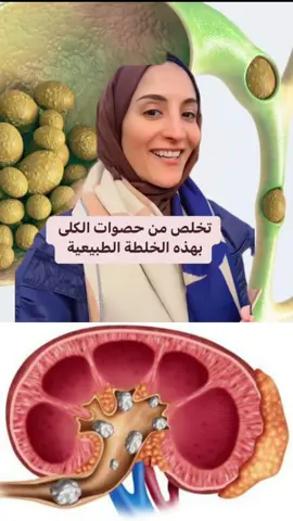 #creatorsearchinsights #اللهم_صلي_على_نبينا_محمد #دكتور #فوائد #صحة #طبيب #for #فوائد_صحية #فوائد_طبيه #تغذية_صحية #fyp #أكل_صحي #healthyfood #healthy #الكلى 