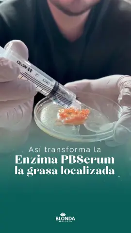 ¡Sí! Así actúan las enzimas PB Serum sobre la grasa localizada de manera rápida y con resultados MARAVILLOSOS🤩💉 👉Si deseas más información acerca de este procedimiento escribenos. ¡Te esperamos!🫰🏻 🏥𝗦𝗲𝗱𝗲 𝗠𝗮𝗴𝗱𝗮𝗹𝗲𝗻𝗮: 📲Reservas al: 924892851 🏥𝗦𝗲𝗱𝗲 Trujillo: 📲Reservas al: 961038701 #PBSERUM #Enzimas #grasalocalizada #verano2025 #procedimiento  #belleza #clinicaestetica #Lima #estetica #trujillo