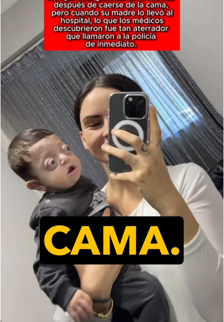 Este bebé terminó con los ojos más grandes de lo normal después de caerse de la cama, pero cuando su madre lo llevó al hospital, lo que los médicos descubrieron fue tan aterrador que llamaron a la policía de inmediato. #usa #us #LearnOnTikTok #truestory