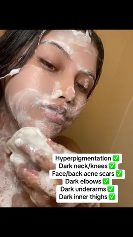 Ive been using it for 5 days now & i can definitely see a difference in the darkness on my neck, underarms & inner thighs ✅📌❤️ #turmeric #turnericsoap #turmericskincare #turmerickojicacidsoap #skincareroutine #fypppppp 