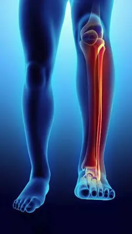PROBLEMAS NO JOELHO QUE INDICAM, QUE PRECISA FAZER CIRURGIA..