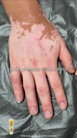 I have only been using this for onemonths and am already seeing results!#12.66