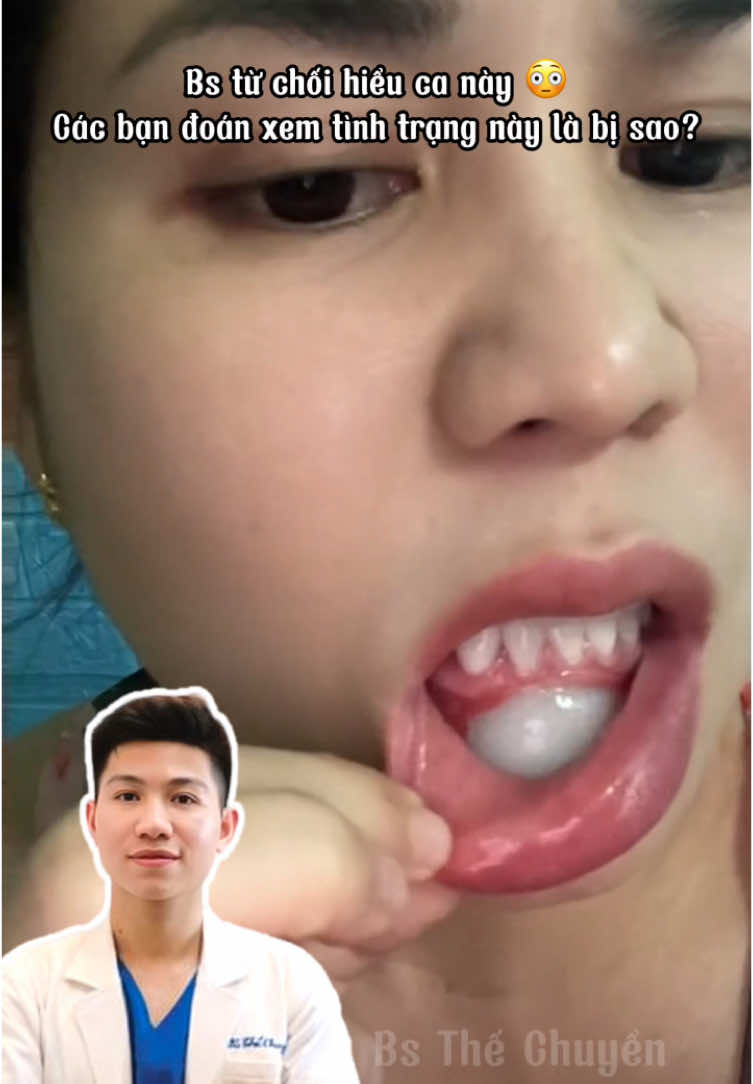 Nhìn mà thấy hơi thốn #bsthechuyen #phauthuatthammy #lamdep #bienchungthammy #doncam #camvline #viral #xh 