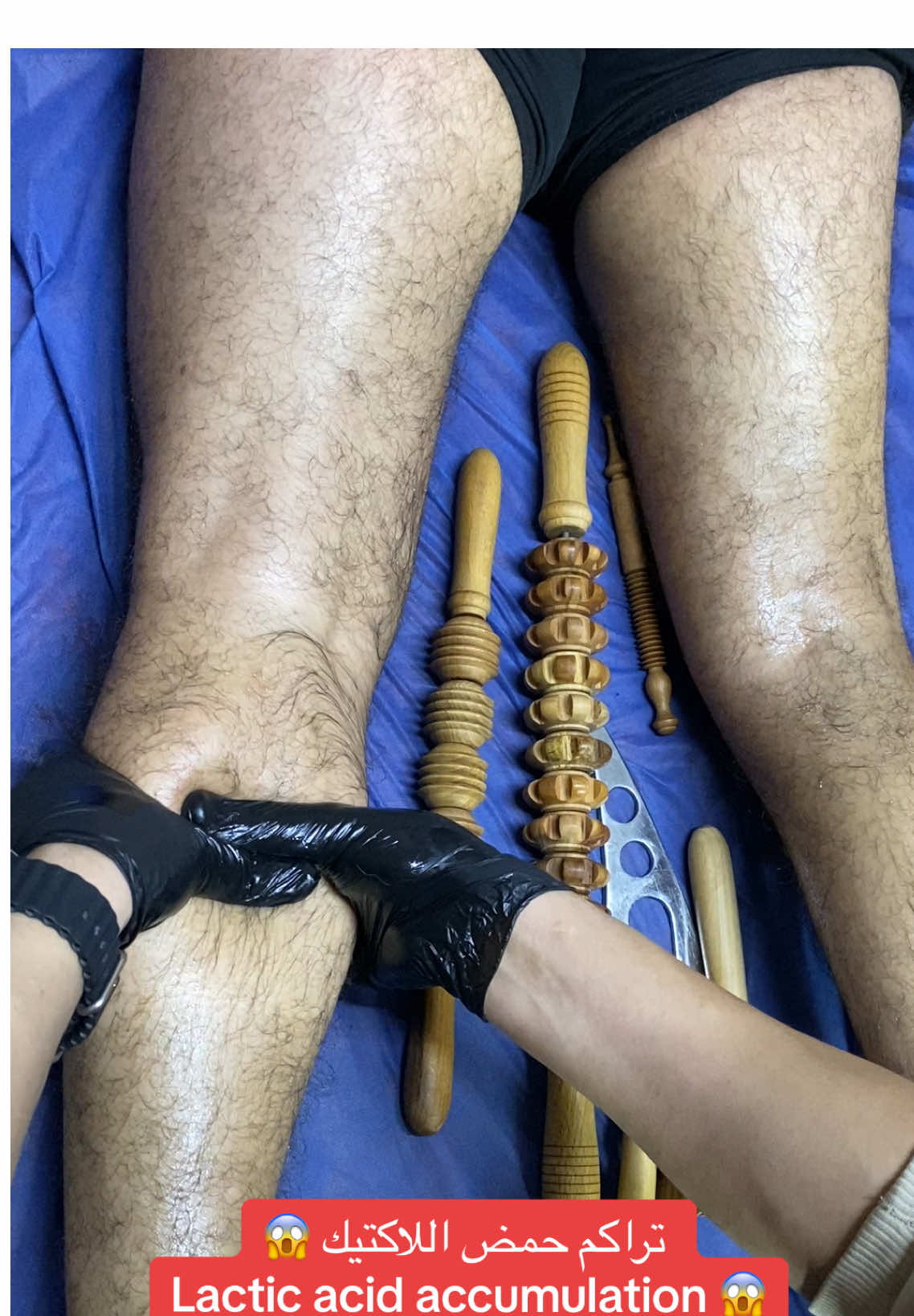 #حمض_اللاكتيك #السائل_الليمفاوي #التعب_العضلي #الم_العضلات #الاستشفاء_العضلي #كرة_قدم #recovery #lacticacid #dr_mohamed_abdelaziz 