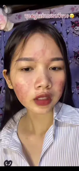 #glutafruitកម្មង់ទិញ☎️010388885 