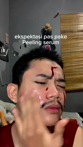 Muka kusam,banyak bekas jerawat, langsung ilang ga heran produknya viral emang se gacor itu 🔥 #fyp #fyppppppppppppppppppppppp #foryou #fyf #foryoupage #xyzbca #fy #xyzbca #fypシ #skintific 