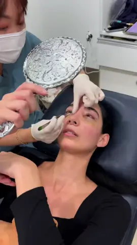 Thank you @HYUNDAI MIHAK CLINIC - SEOUL for making my first time in Seoul amazing! Watch the full vlog on my youtube, link in bio #plasticsurgeonsoftiktok #plasticsurgery #liplift #undereyebags #koreavlog #undereyecircles #undereyefiller 