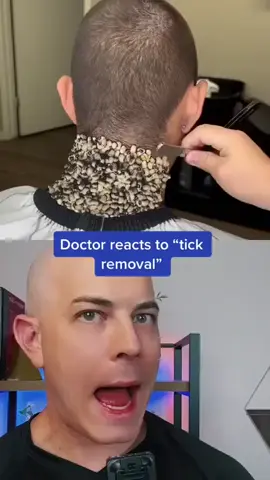 Crazy tick removal- Or fake- #doctor #react #skincare #squeezeyuk #acne #pimple #pimplepop #blackhead #satisfying #foryoupage #foryou  #تنظيف_بشره  #whiteheads #رؤوس_سوداء #عنايه_بالبشره #دهون 