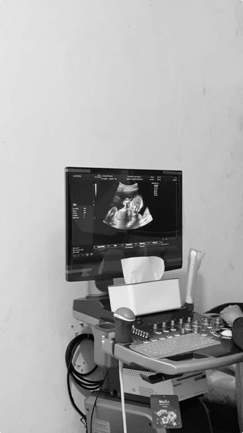 Sehat-sehat anak ku, sampai bertemu di tahun 2025🤍🤍 #kandungan5bulan #usiakehamilan20minggu #usg4d #bayidalamkandungan #janin #bayidalamkandungan #usgkehamilan #fyp #fypage #branda #brandatiktok #brandfyp #fypシ゚ #storykehamilan #ibuhamil #bumil #fypgakni 