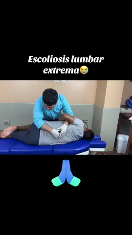 La escoliosis lumbar extrema es una curvatura severa en la parte baja de la columna, causando dolor, rigidez y limitación de movimiento. 🌀 En casos extremos, la quiropráctica no corrige totalmente la curvatura, pero ayuda a reducir el dolor, mejorar la postura y aumentar la movilidad. 💆‍♂️✨ Mediante ajustes precisos, se alivia la presión en los nervios, se equilibra la musculatura y se optimiza la función espinal. 🌟 Es un tratamiento complementario que mejora la calidad de vida en combinación con otros enfoques médicos. 😊#escoliosis 