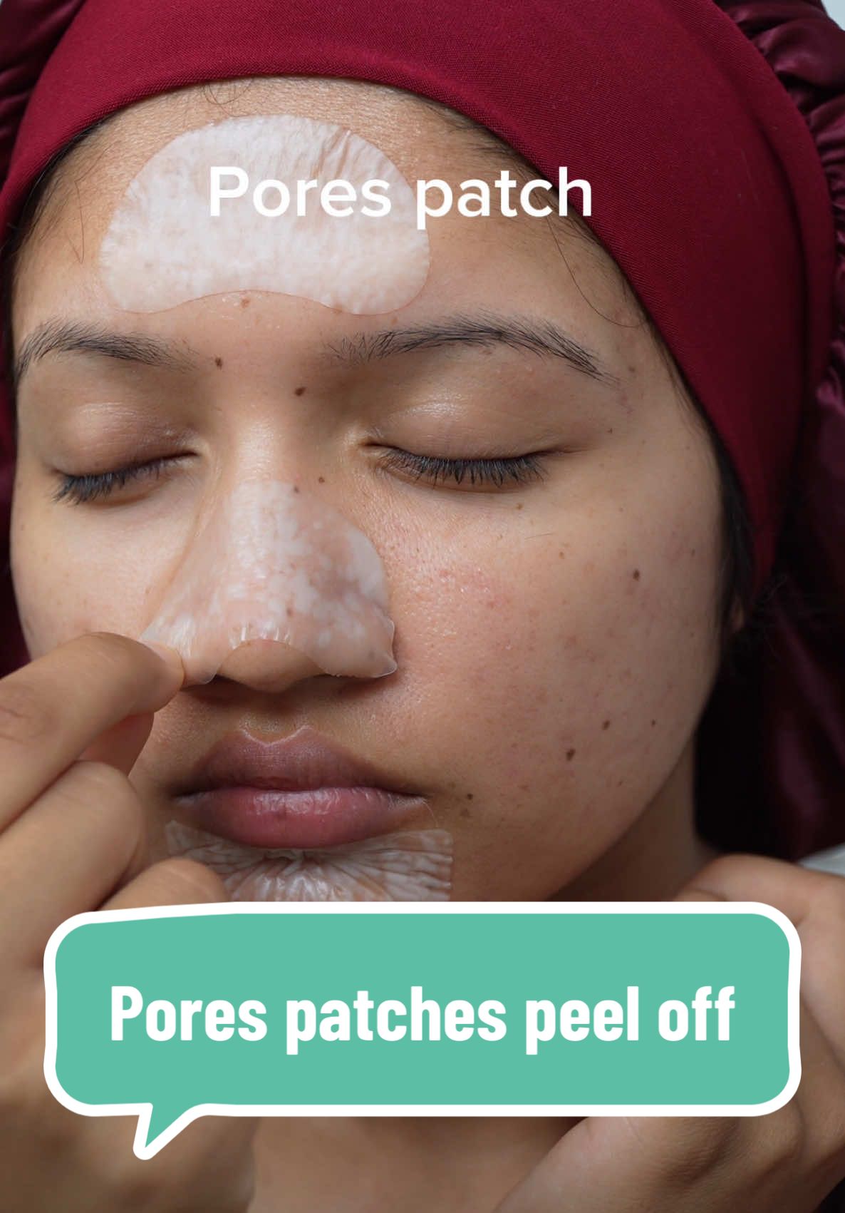 Pore patches peel off✌️  #pores #pore #porestrip #porestripremoval #patches #acnepatch #pimplepatch #patchesremoval #nosestrips #acneskin #acneproneskin #acnestrips #hydrocolloidpatches 