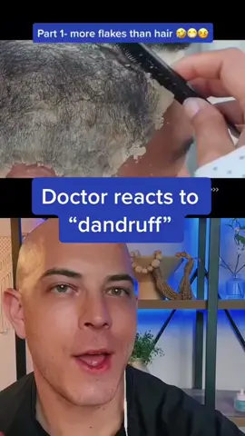Crazy dandruff, but is it real- - #doctor #react #skincare #squeezeyuk #acne #pimple #pimplepop #blackhead #satisfying #foryoupage #foryou  #تنظيف_بشره  #whiteheads #رؤوس_سوداء #عنايه_بالبشره #دهون 