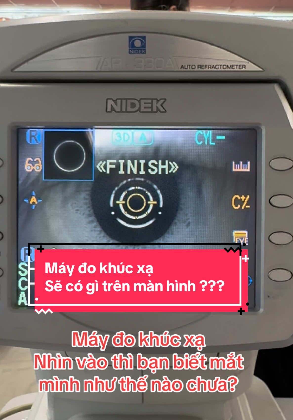 Một trong những qui trình đo khúc xạ…#cậnthị #covymatkinh #matdepmoingay #sưckhoe #mắt #matkinhquan8 