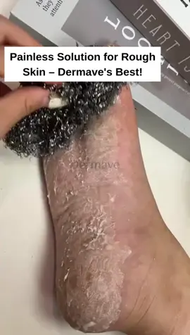 Ready to step confidently? 👣 Dermave’s Electric Foot Callus Remover is here to rescue your feet! No more cracked heels or rough patches—just smooth, refreshed skin. Watch how this device can change the way you feel about your feet. Like, comment, and subscribe for more foot care hacks! ✨ #Dermave #FreshFeet #SmoothSteps #callusremover 